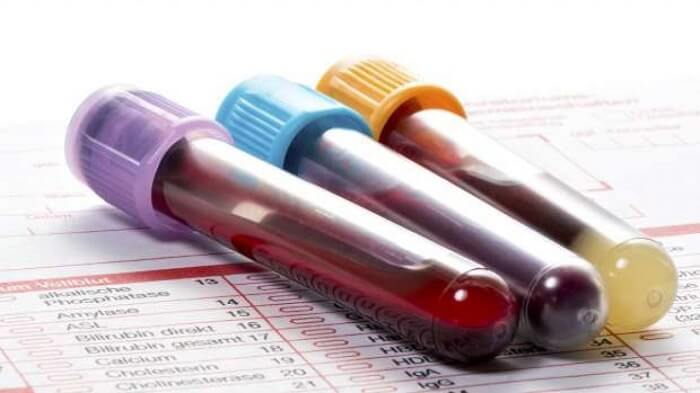 Xét nghiệm máu là một trong những xét nghiệm giúp cho thấy tình trạng sức khỏe của cơ thể